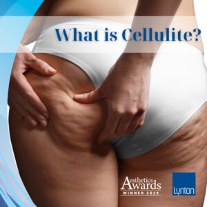 Cellulite Removal